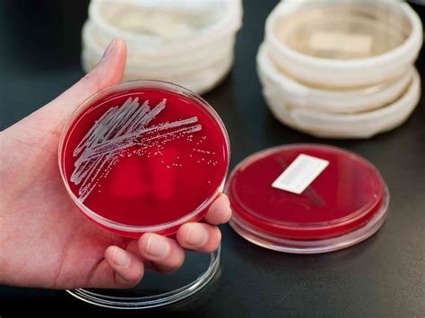 MRSA: Types, Symptoms, Causes, Diagnosis, Treatment and More