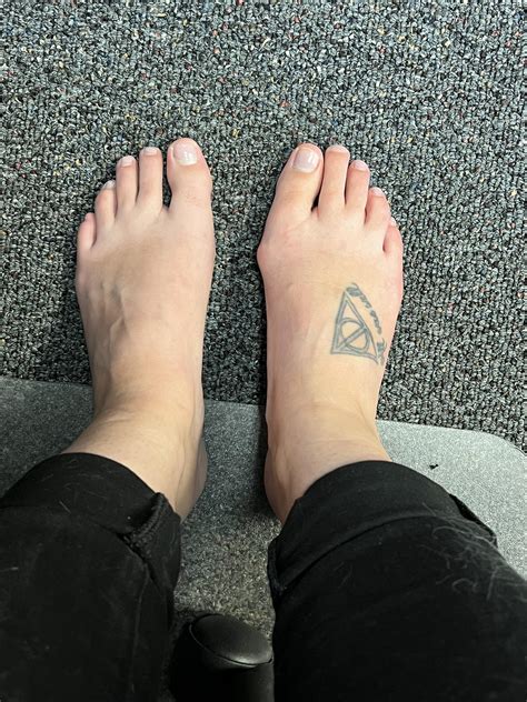 Would you correct now or wait? : r/bunions