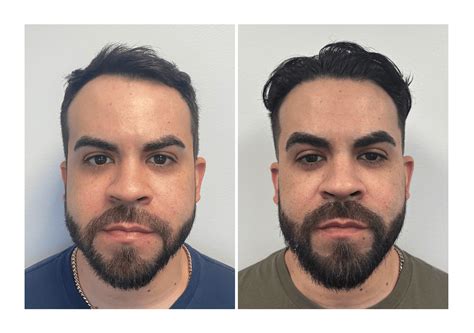 Sammy Ts: Before & After Results That Will Shock You! Image 19