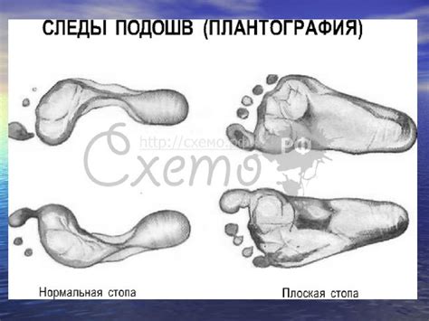 Диспансерное наблюдение за детьми с хроническими заболеваниями - online ...