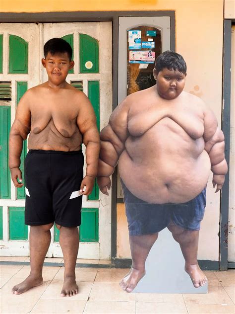 'World's fattest boy' looks unrecognisable after drastic weight loss
