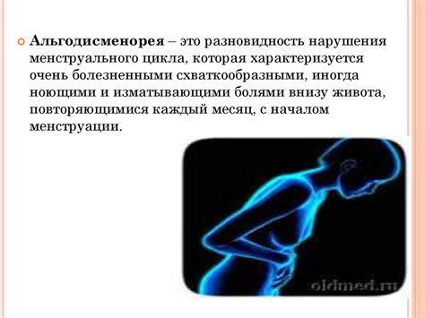 Альгодисменорея. Симптомы заболевания - презентация онлайн