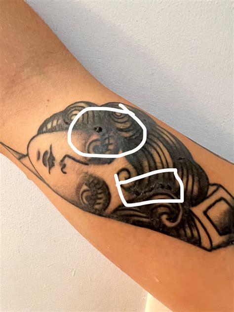 What does a tattoo scar look like - Bronctattooaus.com