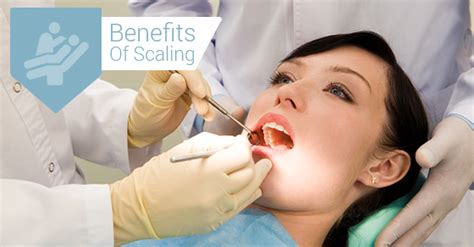 3 Benefits Of Scaling You Did Not Know | City Oasis Dental