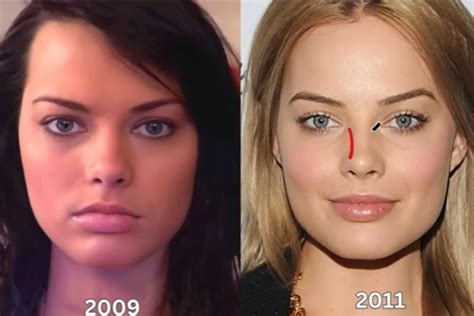 Phun Forum Celebrity Extra: The Truth About Celebrity Plastic Surgery! - zeak20k
