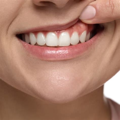 teeth   reasons  tooth translucency