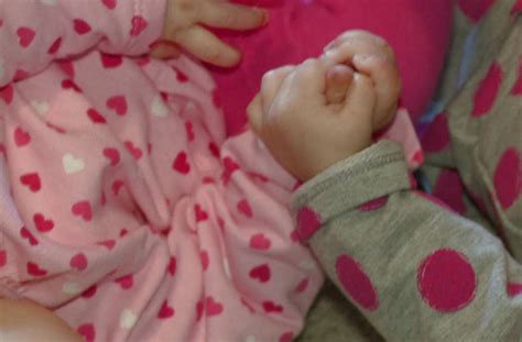 Rare mono mono twins inseparable at six months old