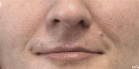 cosmetic face clinics