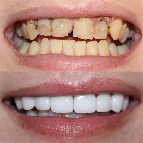 aesthetic digital dentistry primo dental design studio uk