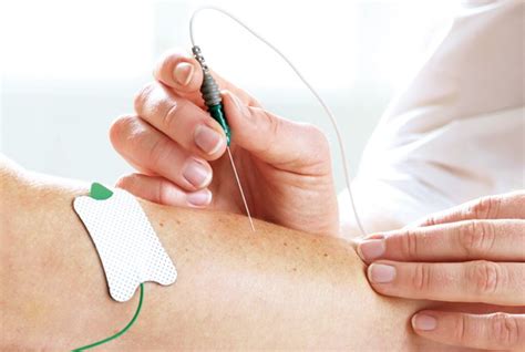 EMG: electromyography – Neurology