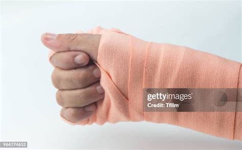 175 Broken Finger Recovery Stock Photos, High-Res Pictures, and Images - Getty Images