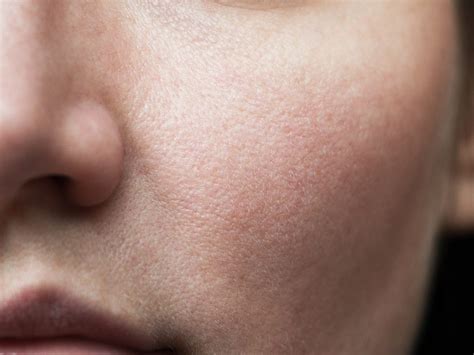 Large Pores: Experts Share How to Diminish Them | Best Health