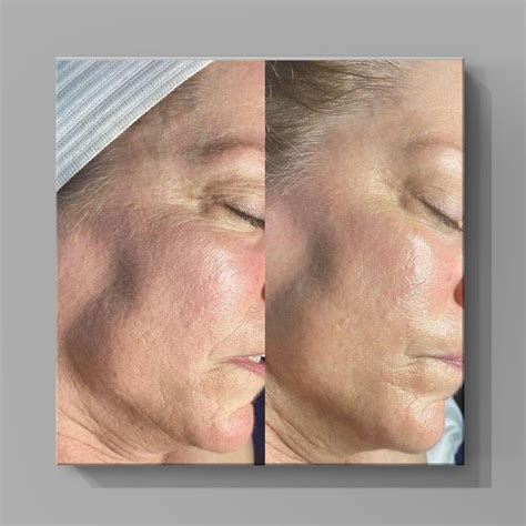 Glow for your Special Holiday Events - Cellsan Med Spa Limassol Cyprus