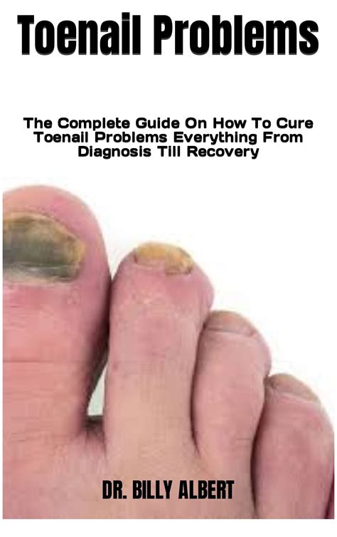 Seniors Toenail Problems at Pamela Walsh blog