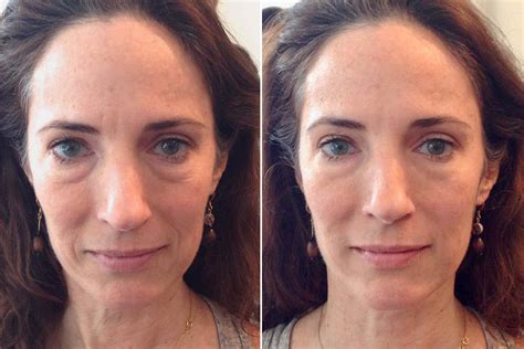 This simple face massage makes you look younger in 90 seconds