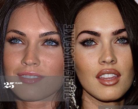 Megan Fox: Before & After Surgery | Megan fox, Megan fox before surgery
