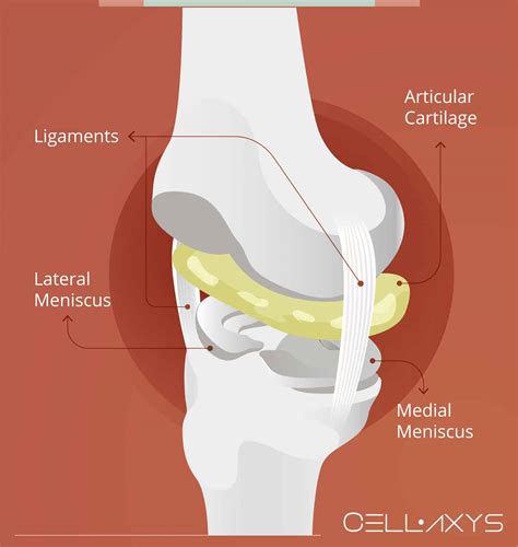 Knee Meniscus Tear Surgery