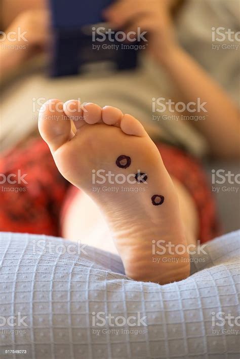 Planters Warts Stock Photo - Download Image Now - Wart, Child, Arts ...