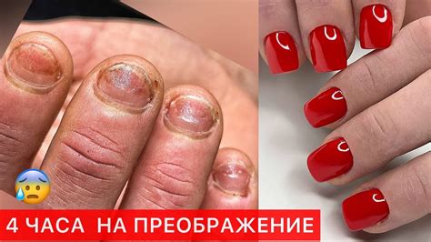 ЗАРОСШАЯ КУТИКУЛА И НАРАЩИВАНИЕ ГРЫЗУНЧИКУ😰СЛОЖНЫЙ МАНИКЮР - YouTube
