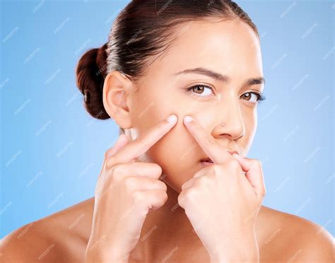 Premium Photo | Woman face and squeeze pimples acne and facial scar on