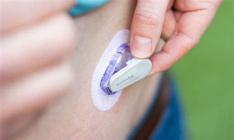 Dexcom G6 Parts Diagram Professional Continuous Glucose Moni