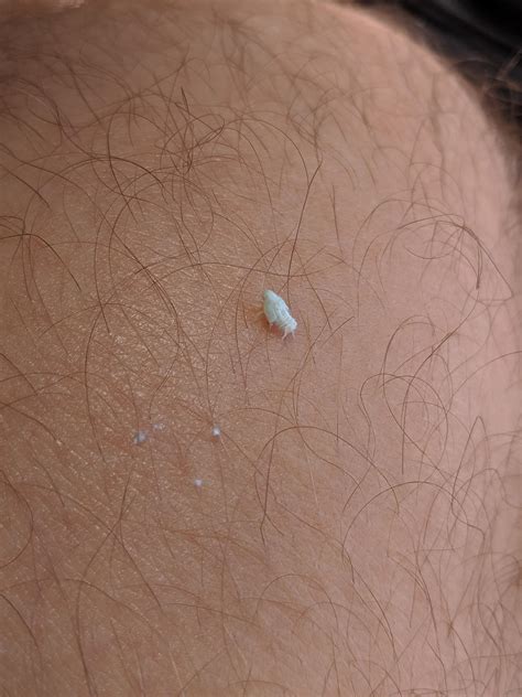 What is this tiny white bug in Paris France. Smaller than a pinky nail