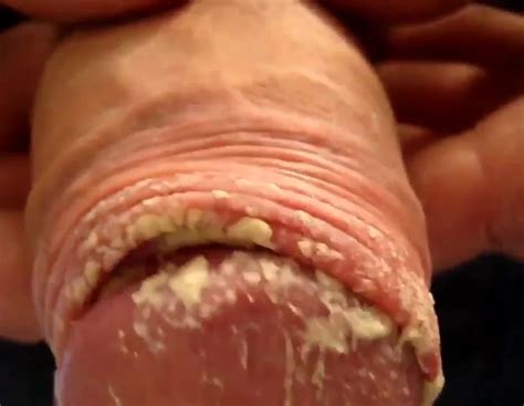 Very stinky big white dick - ThisVid.com