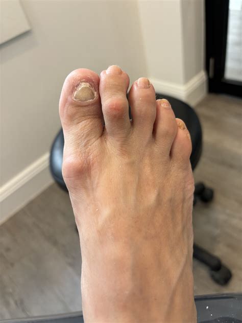 Professional Podiatry Services | Sports Medicine Clinic Parramatta