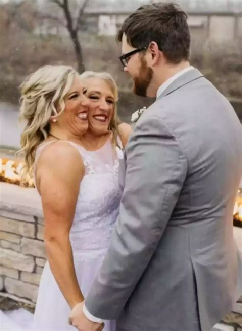 This One Couple's Wedding Will SHOCK You: The Unbelievable Story Of Conjoined Twins Image 8