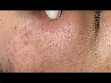 Sac Dep spa, this one is almost 20 minutes of pops : r/popping