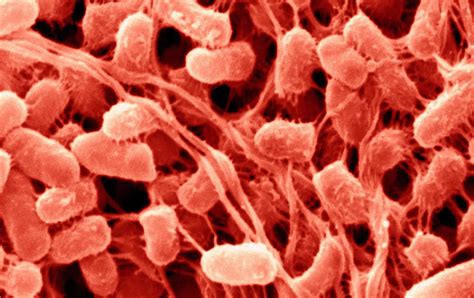 serratia marcescens missy allred