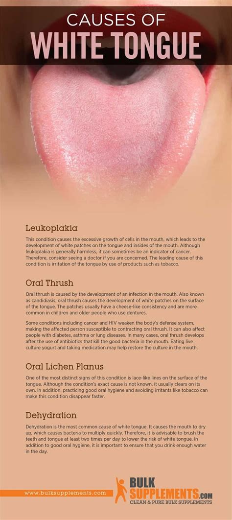 White Tongue. Learn about Treatment, Remedies, & Supplements