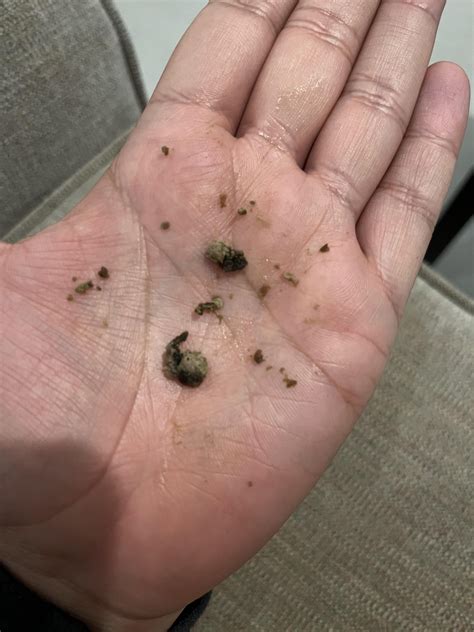 This came out of my mouth today… looks like old coagulated several