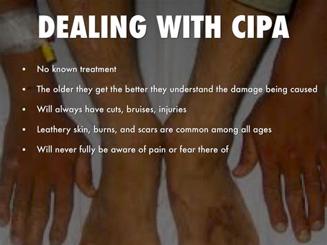 CIPA by Delana Muns