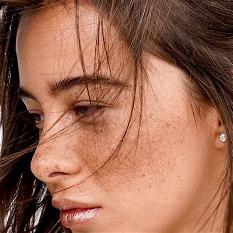 Freckles vs. Sun Damage: Understanding the Differences – SLMD Skincare ...