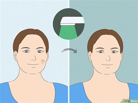 Green Light Therapy: Can It Really Help with Migraine Pain?