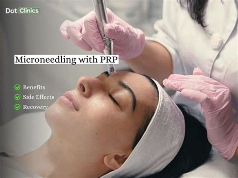 microneedling  prp benefits side effects cost