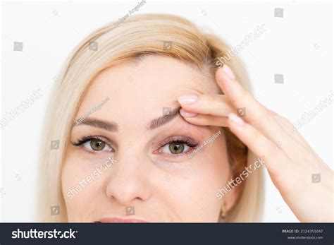 Woman Shows Drooping Eyelid Plastic Surgery Stock Photo 2124351047 ...
