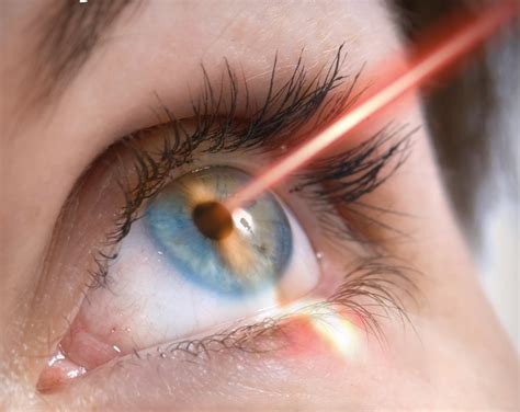 How Long Does Laser Eye Surgery Take - I believe your surgeon should do ...