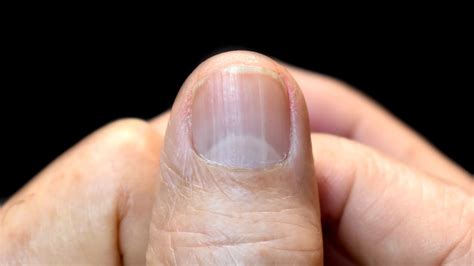 reasons   dont   moons lunula   nails goodrx