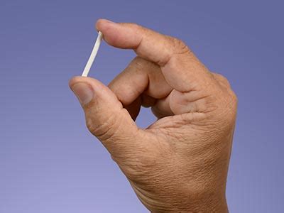 Contraceptive Implant for Birth Control | FPA Women's Health