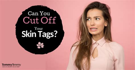 how to cut off a skin tag at home