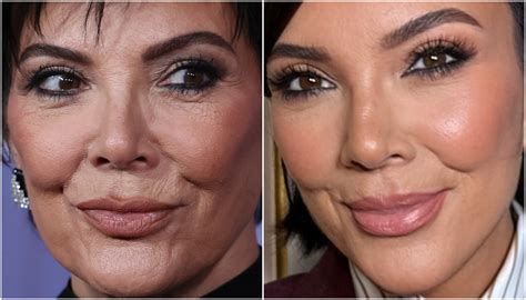 Mae Das Kardashians Antes E Depois - Kris Kardashian Antes E Depois