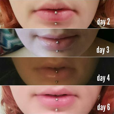 Top 90+ Pictures Nose Piercing Healing Stages With Pictures Completed