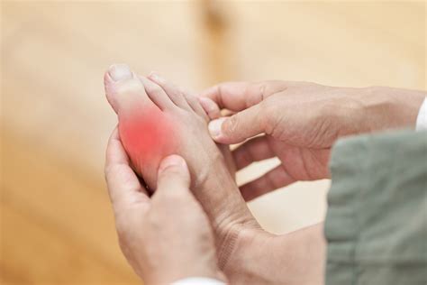 Gout: Causes, Symptoms & Treatment Options