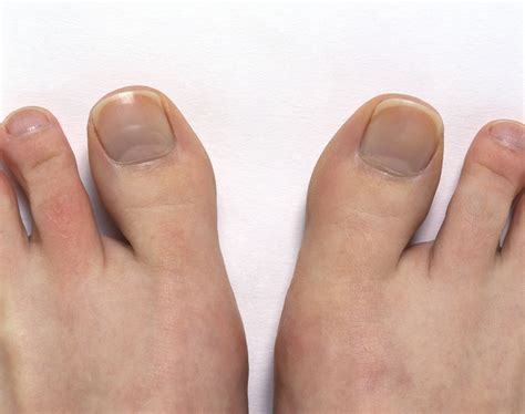 Diagram Of Big Toe Pain Manual