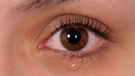 Why do my Tears Burn like Acid? Our Doctor Shares The Real Reason! ⬅️