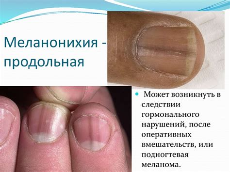 Современный педикюр - презентация онлайн