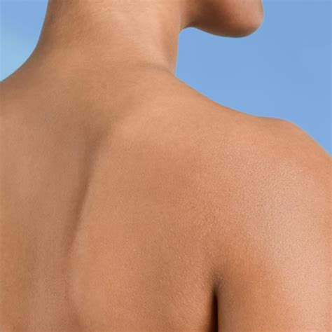 All about senile xerosis: causes, symptoms and treatments