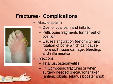 define compound fracture kerysmith